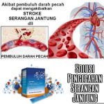 Jual Smartdetox untuk Membentuk Tubuh Menjadi Sehat Ideal di Subang