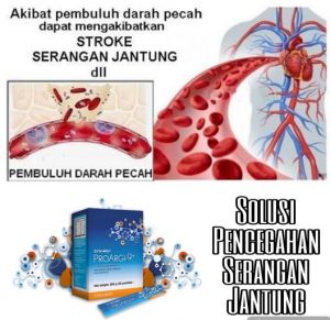 Jual Smartdetox untuk Membentuk Tubuh Menjadi Sehat Ideal di Subang