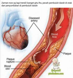 Jual Smartdetox untuk Membentuk Tubuh Menjadi Sehat Ideal di Surabaya Jawa Timur